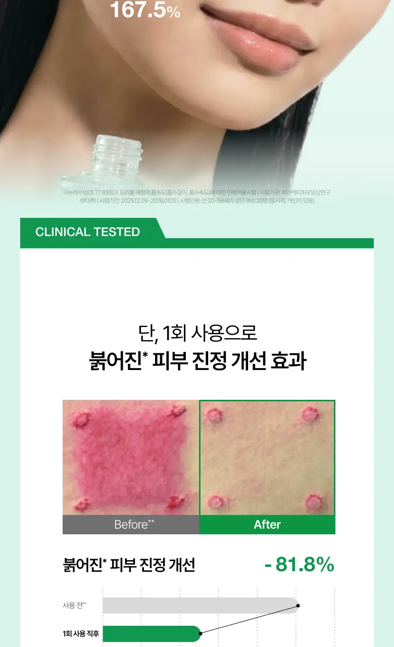 [박희선Pick] 아누아 어성초 77 B3 징크 트러블 세럼 30ml 상세페이지 14